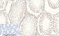 AP-1 (phospho Ser63) Polyclonal Antibody